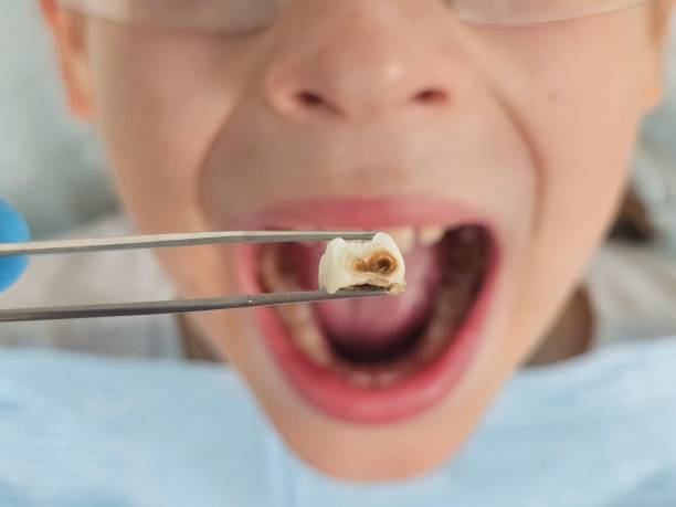 Best Tooth Pain Emergency Relief  in Georgetown, OH